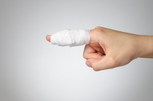 Broken Finger And Blood Clots